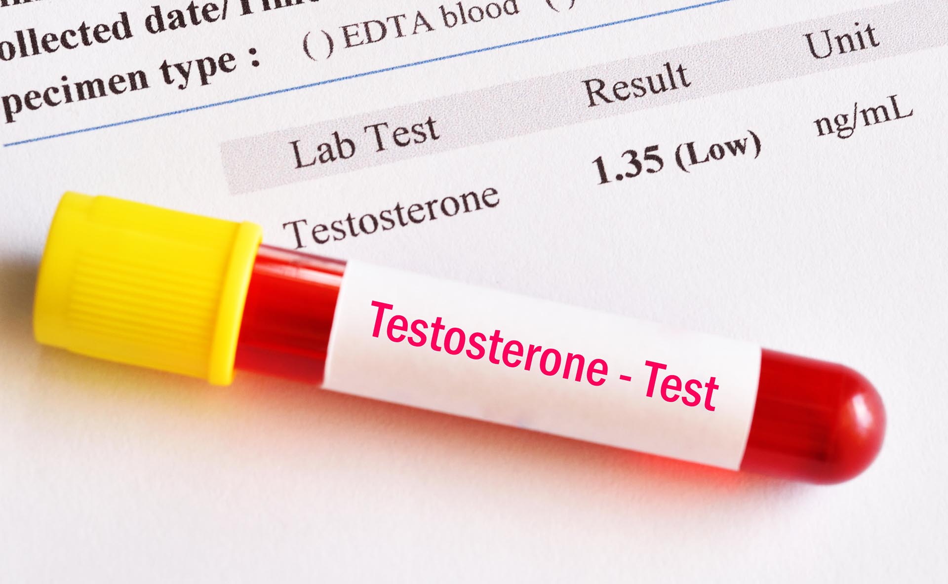 low testosterone and joint damage