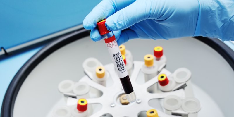 extracting platelet-rich plasma