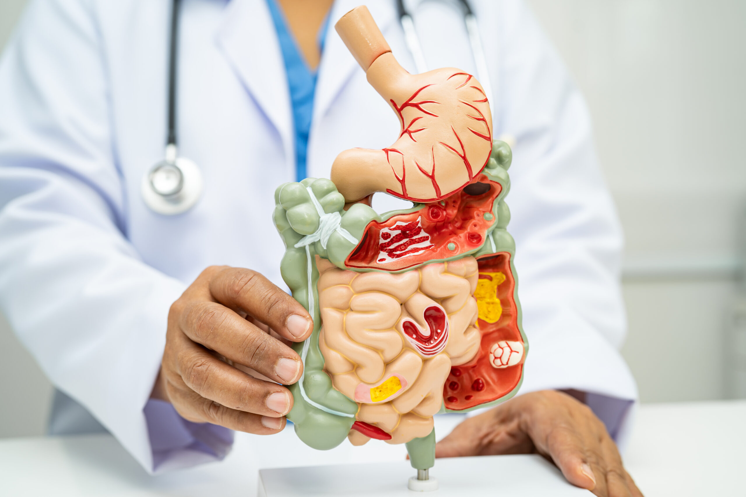 The Gut-Erection Connection